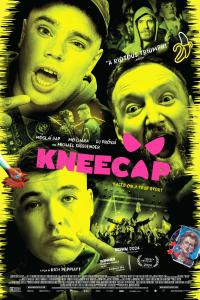 Kneecap.